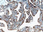 AK2 Antibody in Immunohistochemistry (Paraffin) (IHC (P))