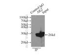 AK2 Antibody in Immunoprecipitation (IP)