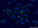 SGTA Antibody in Immunocytochemistry (ICC/IF)