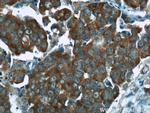 SGTA Antibody in Immunohistochemistry (Paraffin) (IHC (P))