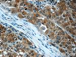 SGTA Antibody in Immunohistochemistry (Paraffin) (IHC (P))