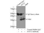 SGTA Antibody in Immunoprecipitation (IP)