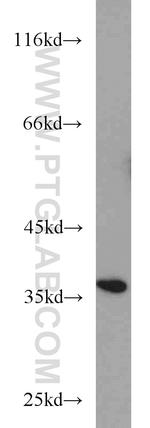 SGTA Antibody in Western Blot (WB)