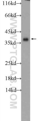 SGTA Antibody in Western Blot (WB)