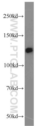 DHX16 Antibody in Western Blot (WB)