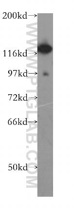 DHX16 Antibody in Western Blot (WB)