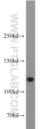 DHX16 Antibody in Western Blot (WB)