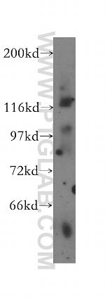 DHX16 Antibody in Western Blot (WB)