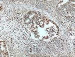 PGM2 Antibody in Immunohistochemistry (Paraffin) (IHC (P))