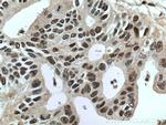 PGM2 Antibody in Immunohistochemistry (Paraffin) (IHC (P))