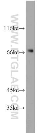 PGM2 Antibody in Western Blot (WB)