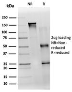 TDRKH Antibody in Immunoelectrophoresis (IE)