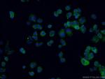 RAB33A Antibody in Immunocytochemistry (ICC/IF)