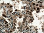 CDK4 Antibody in Immunohistochemistry (Paraffin) (IHC (P))