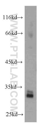 CDK4 Antibody in Western Blot (WB)