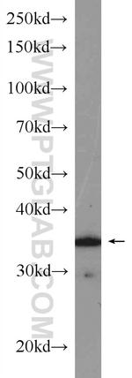 CDK4 Antibody in Western Blot (WB)