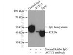 alpha Actin Antibody in Immunoprecipitation (IP)