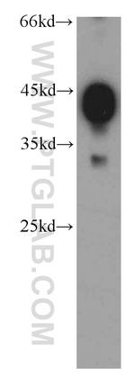 alpha Actin Antibody in Western Blot (WB)