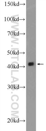 alpha Actin Antibody in Western Blot (WB)