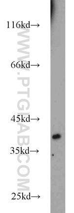 EIF2B2 Antibody in Western Blot (WB)