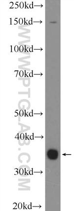 EIF2B2 Antibody in Western Blot (WB)