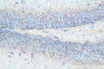 EIF2B2 Antibody in Immunohistochemistry (Paraffin) (IHC (P))