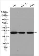 EIF2B2 Antibody in Western Blot (WB)