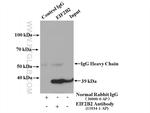 EIF2B2 Antibody in Immunoprecipitation (IP)