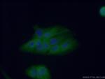 HPGD Antibody in Immunocytochemistry (ICC/IF)