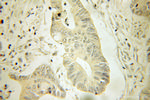 HPGD Antibody in Immunohistochemistry (Paraffin) (IHC (P))