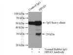 HPGD Antibody in Immunoprecipitation (IP)