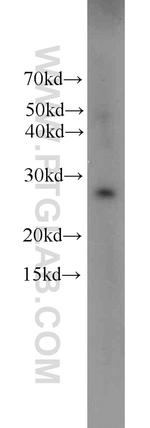 HPGD Antibody in Western Blot (WB)