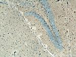 Glutamine synthetase Antibody in Immunohistochemistry (Paraffin) (IHC (P))