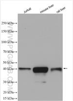 Glutamine synthetase Antibody in Western Blot (WB)