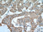 Glutamine synthetase Antibody in Immunohistochemistry (Paraffin) (IHC (P))