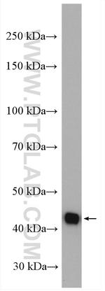 Glutamine synthetase Antibody in Western Blot (WB)