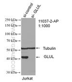 Glutamine synthetase Antibody in Western Blot (WB)