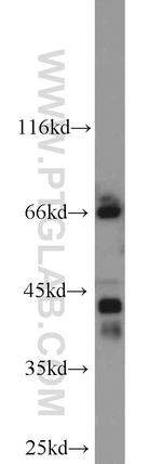 Glutamine synthetase Antibody in Western Blot (WB)