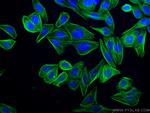 TPM2 Antibody in Immunocytochemistry (ICC/IF)