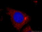 TPM2 Antibody in Immunocytochemistry (ICC/IF)