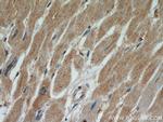 TPM2 Antibody in Immunohistochemistry (Paraffin) (IHC (P))