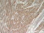 TPM2 Antibody in Immunohistochemistry (Paraffin) (IHC (P))