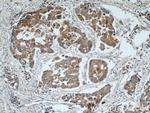 TPM2 Antibody in Immunohistochemistry (Paraffin) (IHC (P))