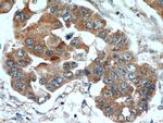 TPM2 Antibody in Immunohistochemistry (Paraffin) (IHC (P))