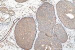 TPM2 Antibody in Immunohistochemistry (Paraffin) (IHC (P))