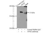 TPM2 Antibody in Immunoprecipitation (IP)