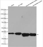 TPM2 Antibody in Western Blot (WB)