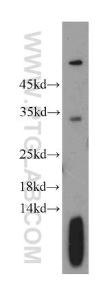 TPM2 Antibody in Western Blot (WB)