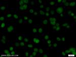 Transketolase Antibody in Immunocytochemistry (ICC/IF)