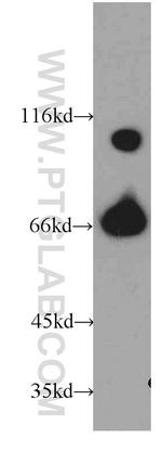 Transketolase Antibody in Western Blot (WB)